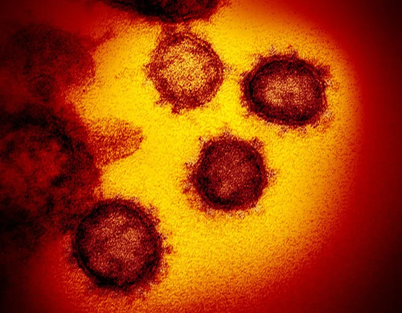 Colatina chega a 25 casos confirmados de Covid-19 nesta quarta-feira (29). Dois homens entorno de 40 anos são os novos contaminados