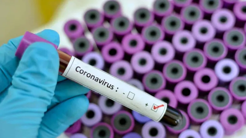 Coronavírus: com 12 casos confirmados nesta quarta-feira (20), Colatina chega a 139 contaminados