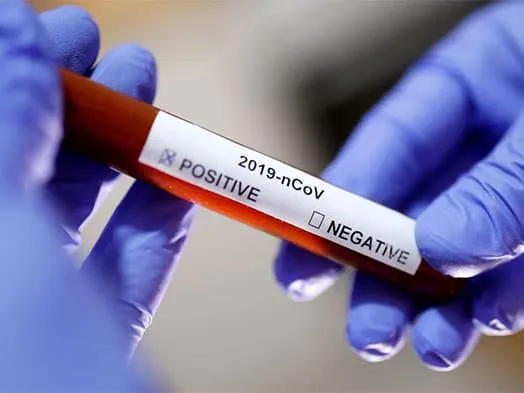Covid-19: 129 mortes e mais 83 casos de contaminação em dois dias. Veja os números atualizados de Colatina