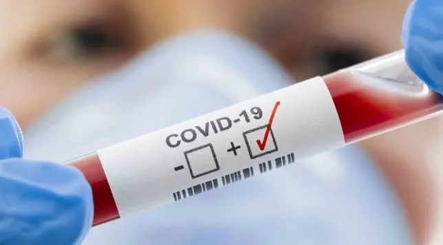 Novo coronavírus: Colatina inicia a quarta-feira (11), com mais 70 casos