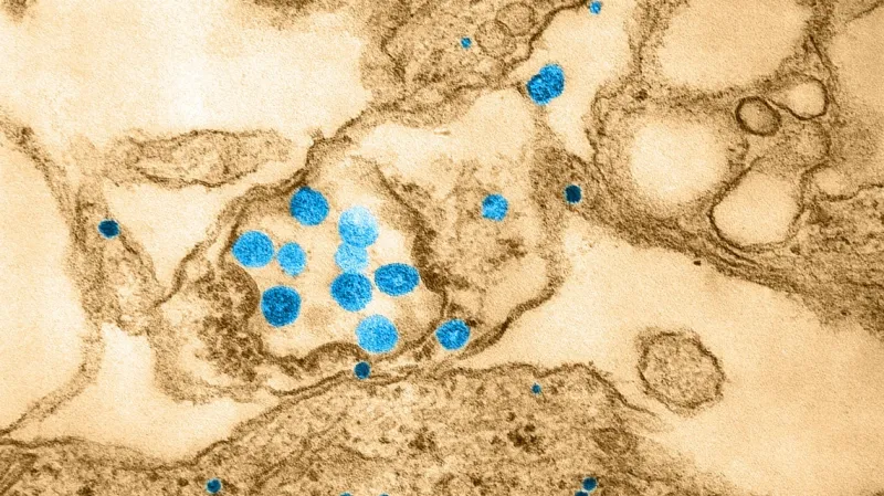 Coronavírus: Colatina contabiliza 193 mortes e 28 novos casos