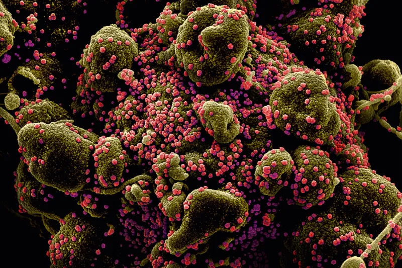 Coronavírus: Colatina contabiliza 180 mortes e 13 novos casos