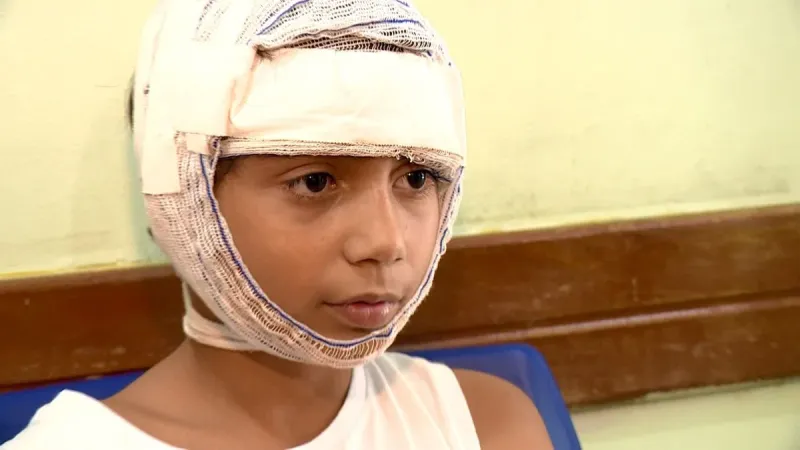 Criança de 9 anos atacada por cachorro no Bairro Vicente Soella III, em Colatina, passa por cirurgia