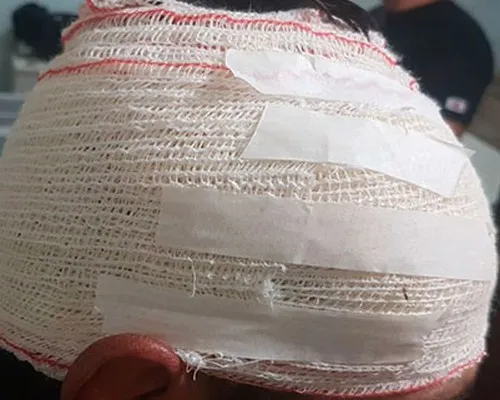 Briga entre andarilhos em Baixo Guandu termina com homem ferido na cabeça