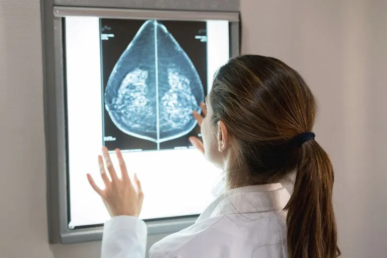 SUS vai oferecer mamografia para mulheres a partir dos 40 anos e ampliar rastreamento até os 74