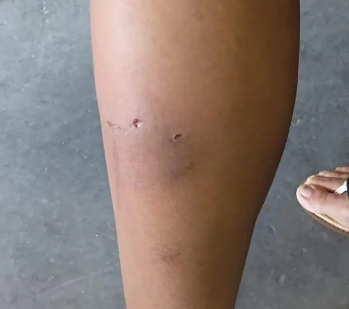 Moradores denunciam ataques de cães soltos no bairro Barbados, em Colatina