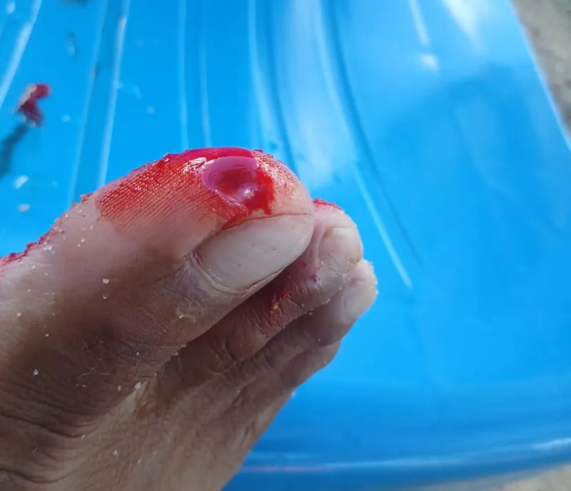 Ataques de piranha assustam banhistas em lagoa frequentada por moradores de Colatina e região