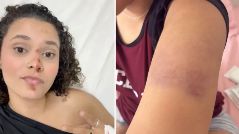 Vídeo: touro foge de rodeio, provoca pânico e deixa jovem ferida durante festa em Baixo Guandu